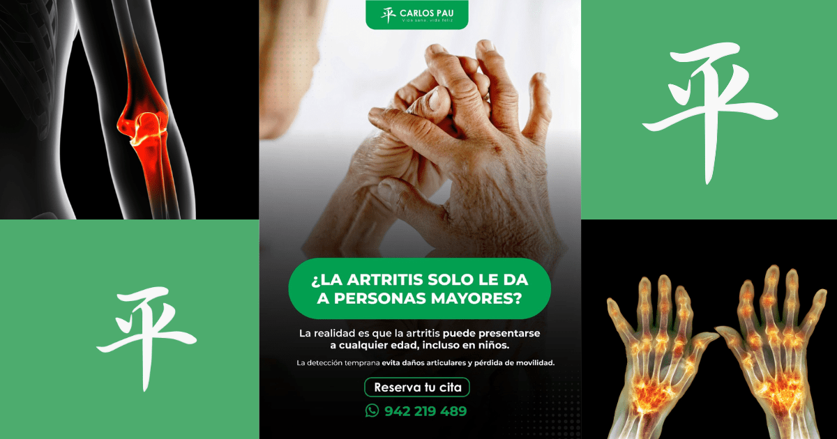 ¿Artritis solo en personas mayores? Derribamos el mito y te explicamos la importancia de la detección temprana